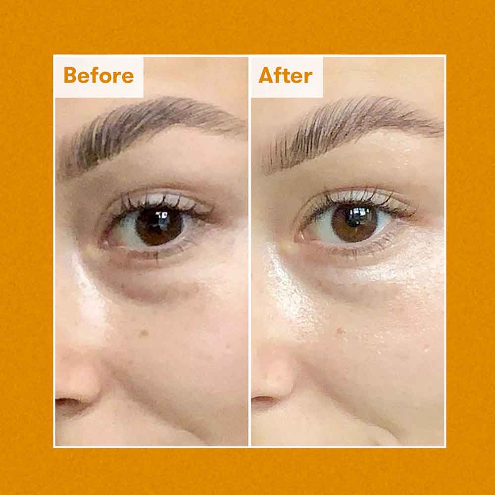 Brightening Dark Circle Eye Cream